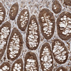 Invitrogen COMMD8 Polyclonal Antibody 100 &mu;L; Unconjugated:Antibodies,