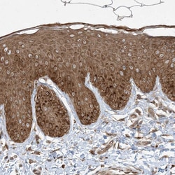 Invitrogen COMMD8 Polyclonal Antibody 100 &mu;L; Unconjugated:Antibodies,