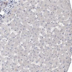 Invitrogen UBTD2 Polyclonal Antibody 100 &mu;L | Buy Online | Invitrogen&trade; | Fisher Scientific