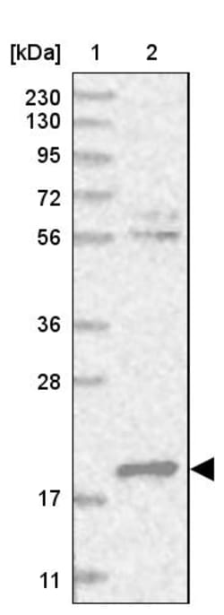 Invitrogen DCTD Polyclonal Antibody 100 &mu;L | Buy Online | Invitrogen&trade; | Fisher Scientific