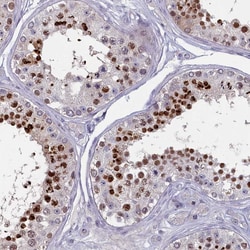 Invitrogen FAM196A Polyclonal Antibody 100 &mu;L; Unconjugated:Antibodies,