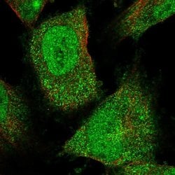 Invitrogen FAM206A Polyclonal Antibody 100 &mu;L; Unconjugated:Antibodies,