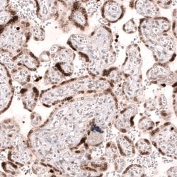 Invitrogen NUP54 Polyclonal Antibody 100 &mu;L; Unconjugated:Antibodies,