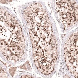 Invitrogen NUP54 Polyclonal Antibody 100 &mu;L; Unconjugated:Antibodies,