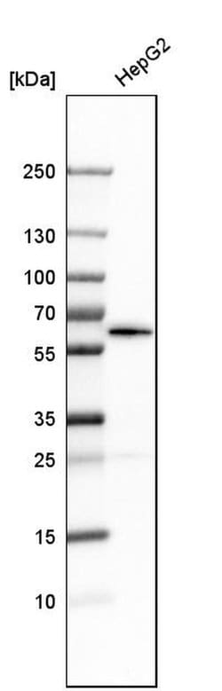 Invitrogen NUP54 Polyclonal Antibody 100 &mu;L; Unconjugated:Antibodies,