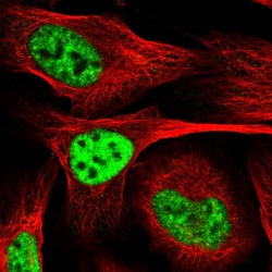 Invitrogen PLRG1 Polyclonal Antibody 100 &mu;L; Unconjugated:Antibodies,