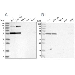 Invitrogen PLRG1 Polyclonal Antibody 100 &mu;L; Unconjugated:Antibodies,