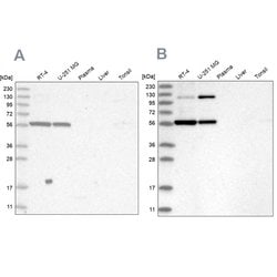 Invitrogen PLRG1 Polyclonal Antibody 100 &mu;L; Unconjugated:Antibodies,