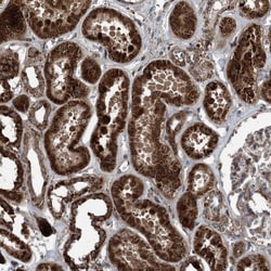 Invitrogen NDUFA2 Polyclonal Antibody 100 &mu;L; Unconjugated:Antibodies,