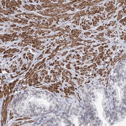 Invitrogen RBM27 Polyclonal Antibody 100 &mu;L | Buy Online | Invitrogen&trade; | Fisher Scientific