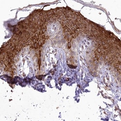 Invitrogen RBM27 Polyclonal Antibody 100 &mu;L | Buy Online | Invitrogen&trade; | Fisher Scientific