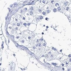 Invitrogen CSN3 (CASK) Polyclonal Antibody 100 &mu;L; Unconjugated:Antibodies,