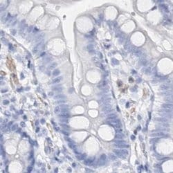 Invitrogen CSN3 (CASK) Polyclonal Antibody 100 &mu;L; Unconjugated:Antibodies,