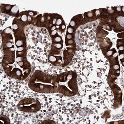 Invitrogen ZNF488 Polyclonal Antibody 100 &mu;L; Unconjugated:Antibodies,