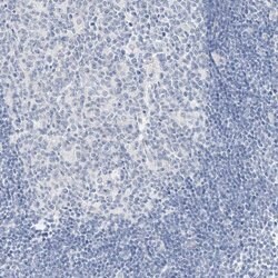 Invitrogen SLC22A13 Polyclonal Antibody 100 &mu;L | Buy Online | Invitrogen&trade; | Fisher Scientific