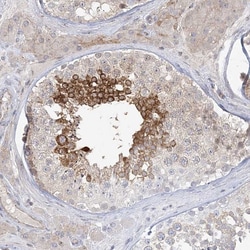 Invitrogen ADAMTS12 Polyclonal Antibody 100 &mu;L; Unconjugated:Antibodies,