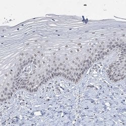 Invitrogen KMT2D Polyclonal Antibody 100 &mu;L; Unconjugated:Antibodies,