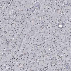 Invitrogen KMT2D Polyclonal Antibody 100 &mu;L; Unconjugated:Antibodies,