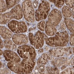 Invitrogen FEZ2 Polyclonal Antibody 100 &mu;L; Unconjugated:Antibodies,