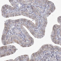 Invitrogen ZC3H6 Polyclonal Antibody 100 &mu;L; Unconjugated:Antibodies,