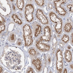 Invitrogen ADCK2 Polyclonal Antibody 100 &mu;L | Buy Online | Invitrogen&trade; | Fisher Scientific