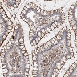Invitrogen SPPL2A Polyclonal Antibody 100 &mu;L | Buy Online | Invitrogen&trade; | Fisher Scientific