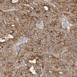 Invitrogen SPPL2A Polyclonal Antibody 100 &mu;L | Buy Online | Invitrogen&trade; | Fisher Scientific