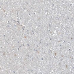 Invitrogen SPPL2A Polyclonal Antibody 100 &mu;L | Buy Online | Invitrogen&trade; | Fisher Scientific