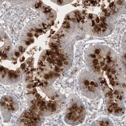 Invitrogen PRSS36 Polyclonal Antibody 100 &mu;L; Unconjugated:Antibodies,