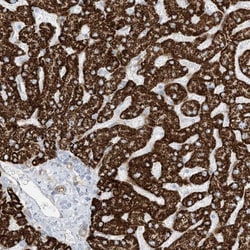 Invitrogen PID1 Polyclonal Antibody 100 &mu;L; Unconjugated:Antibodies,