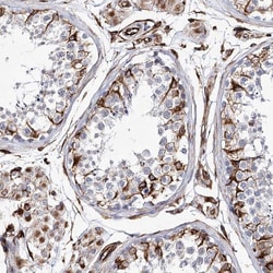 Invitrogen ALG1L Polyclonal Antibody 100 &mu;L; Unconjugated:Antibodies,