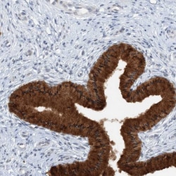 Invitrogen ASCL4 Polyclonal Antibody 100 &mu;L; Unconjugated:Antibodies,