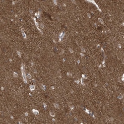 Invitrogen LAGE3 Polyclonal Antibody 100 &mu;L; Unconjugated:Antibodies,