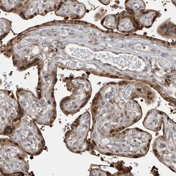 Invitrogen LAGE3 Polyclonal Antibody 100 &mu;L; Unconjugated:Antibodies,