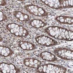 Invitrogen LAGE3 Polyclonal Antibody 100 &mu;L; Unconjugated:Antibodies,