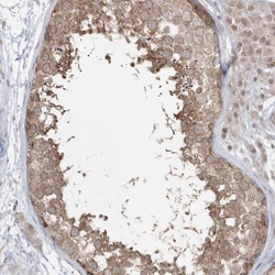 Invitrogen DHX57 Polyclonal Antibody 100 &mu;L; Unconjugated:Antibodies,