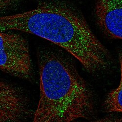 Invitrogen MITD1 Polyclonal Antibody 100 &mu;L; Unconjugated:Antibodies,