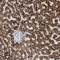 Invitrogen MITD1 Polyclonal Antibody 100 &mu;L; Unconjugated:Antibodies,