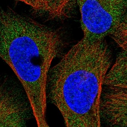 Invitrogen UMPS Polyclonal Antibody 100 &mu;L; Unconjugated:Antibodies,