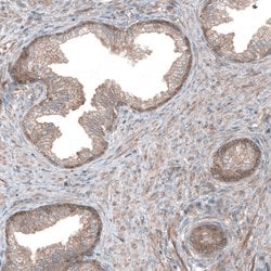 Invitrogen UMPS Polyclonal Antibody 100 &mu;L; Unconjugated:Antibodies,