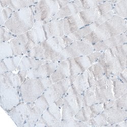 Invitrogen UMPS Polyclonal Antibody 100 &mu;L; Unconjugated:Antibodies,