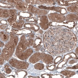 Invitrogen UMPS Polyclonal Antibody 100 &mu;L; Unconjugated:Antibodies,