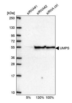 Invitrogen UMPS Polyclonal Antibody 100 &mu;L; Unconjugated:Antibodies,