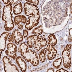 Invitrogen UMPS Polyclonal Antibody 100 &mu;L; Unconjugated:Antibodies,
