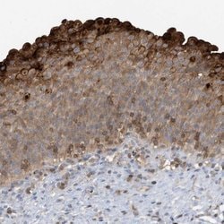 Invitrogen NSUN3 Polyclonal Antibody 100 &mu;L; Unconjugated:Antibodies,