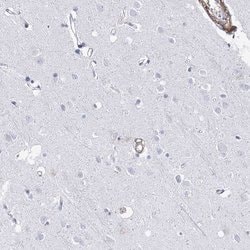 Invitrogen ANKRD23 Polyclonal Antibody 100 &mu;L; Unconjugated:Antibodies,