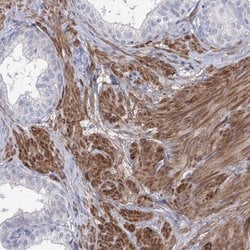 Invitrogen ANKRD23 Polyclonal Antibody 100 &mu;L; Unconjugated:Antibodies,