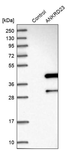 Invitrogen ANKRD23 Polyclonal Antibody 100 &mu;L; Unconjugated:Antibodies,