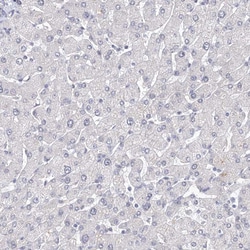 Invitrogen SLC7A7 Polyclonal Antibody 100 &mu;L; Unconjugated:Antibodies,