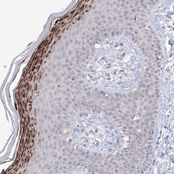 Invitrogen SLC7A7 Polyclonal Antibody 100 &mu;L; Unconjugated:Antibodies,